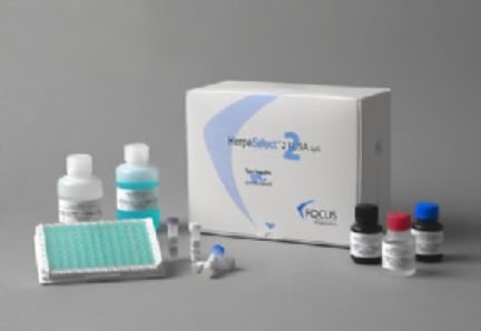 小鼠白三烯C4试剂盒