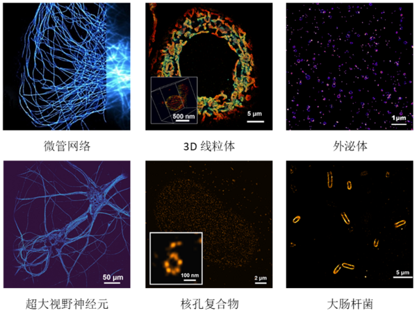 單分子超分辨成像系統順利落戶多所知名院校，助力我國高校捕獲微觀世界“奇跡”！