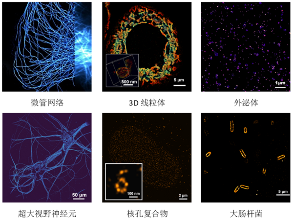 单分子超分辨成像系统顺利落户多所知名院校，助力我国高校捕获微观世界“奇迹”！