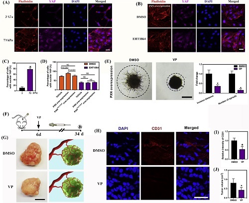 Bioactive Materials：血管生成的重大突破——基质硬度通过 p-PXN-Rac1-YAP 信号轴调节细胞形成