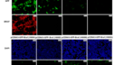 Anti BRaf(V600E) Mouse Monoclonal Antibody