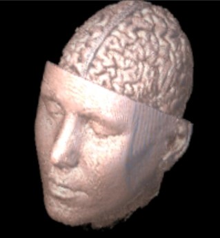 3D-DOCTOR | 三维图像处理软件
